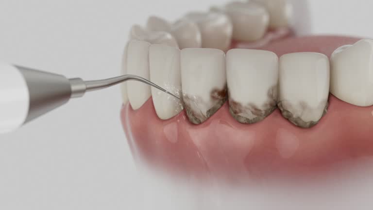 Reliable Dental Implants contractor in Pottawatomie County County, OK by Dentist Open Now